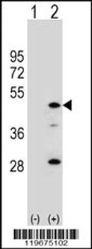 AADAC Antibody (C-term)