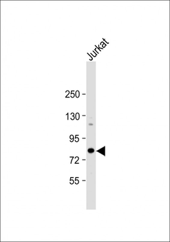 ALKBH8 Antibody (C-term)