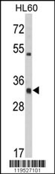 HLA-DRA Antibody (C-term)