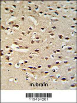 Chromogranin-C Antibody (Center)