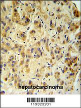 FUCA1 Antibody (Center)