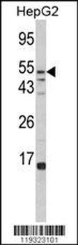FUCA1 Antibody (Center)