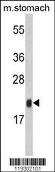 FKBP11 Antibody (N-term)