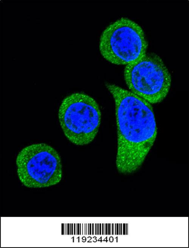 CRHR2 Antibody (Center)