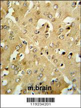 CRHR2 Antibody (Center)