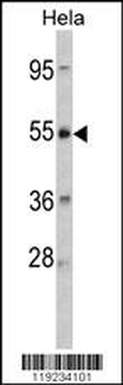 CRHR2 Antibody (Center)