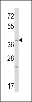 WNT1 Antibody (C-term)