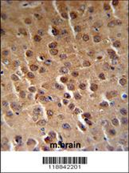 PFTK1 Antibody (N-term P82)