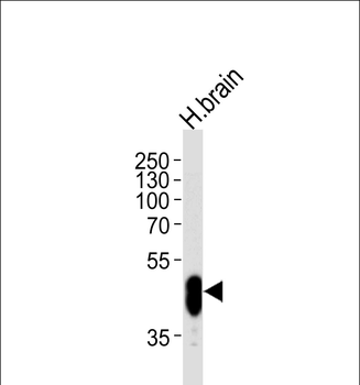 PFTK1 Antibody (N-term P82)