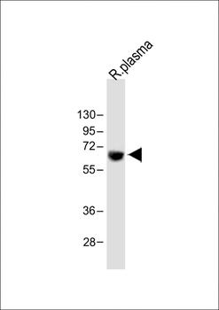 TPA Antibody (Center)