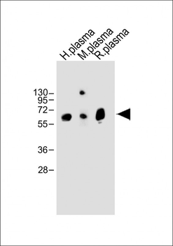 TPA Antibody (Center)