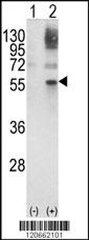 GATA2 Antibody (Center)