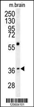 MAPRE1 Antibody (N-term)