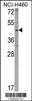 KYNU Antibody (C-term)