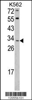 ITM2A Antibody (N-term)