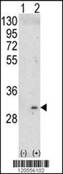 ITM2A Antibody (N-term)