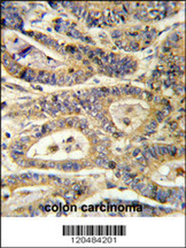 IGFBP6 Antibody (C-term)