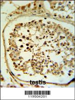 Fascin-3 Antibody (N-term)