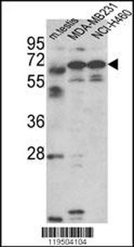 Fascin-3 Antibody (N-term)