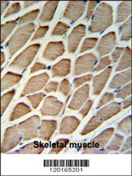 GBAS Antibody (Center)