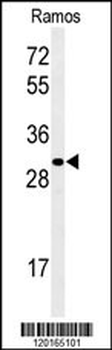 GBAS Antibody (Center)