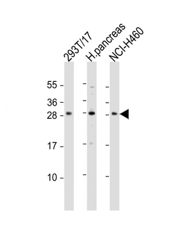 COMTD1 Antibody (C-term)