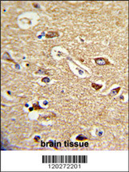 TOMM70A Antibody (C-term)