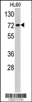 TOMM70A Antibody (C-term)