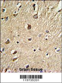 BGN Antibody (Center)