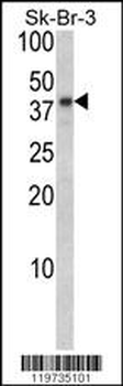 BGN Antibody (Center)