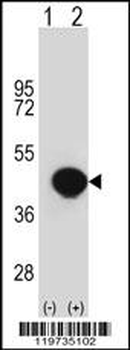 BGN Antibody (Center)