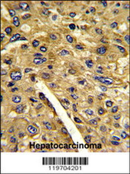 AMT Antibody (N-term)