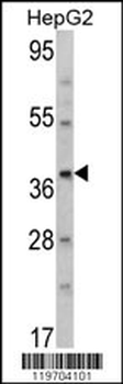 AMT Antibody (N-term)