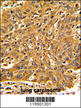 Fascin Antibody (Center)