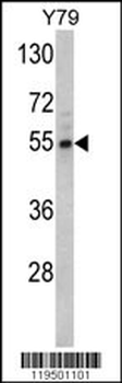 Fascin Antibody (Center)