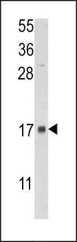 FKBP2 Antibody (N-term)