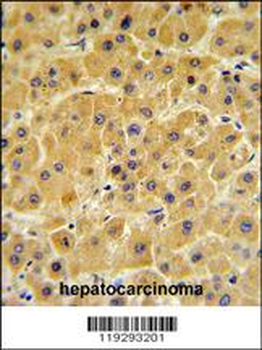 F10 Antibody (C-term)