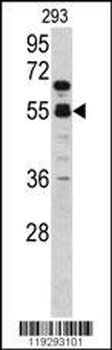F10 Antibody (C-term)