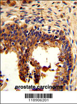 KRT4 Antibody (C-term)