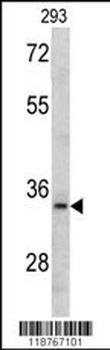 MCA1 Antibody (C-term)