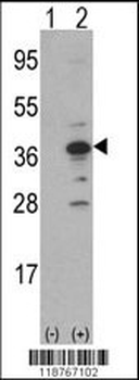MCA1 Antibody (C-term)