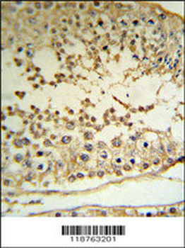 MAPE Antibody (C-term)