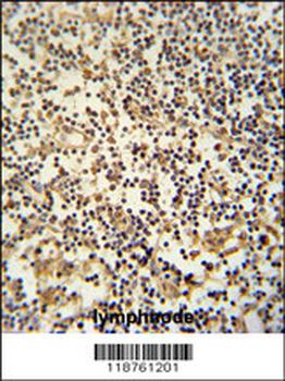 MAML3 Antibody (C-term)