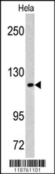 MAML3 Antibody (C-term)