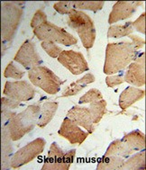 MVD Antibody (Center)