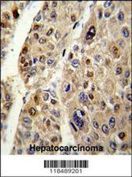 SERPINC1 Antibody (C-term)