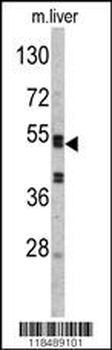 SERPINC1 Antibody (C-term)