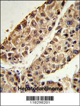 ITIH2 Antibody (C-term)