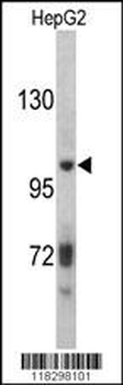 ITIH2 Antibody (C-term)