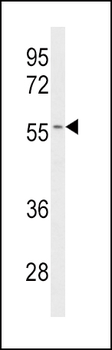 CYP2C19 Antibody (Center)